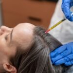 Use Derma Stamp for Hair Growth