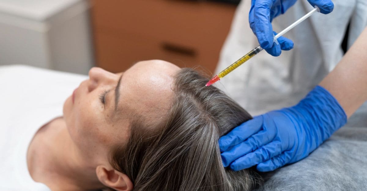 Use Derma Stamp for Hair Growth